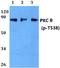 Protein Kinase C Theta antibody, A01293T538, Boster Biological Technology, Western Blot image 