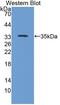 Talin 2 antibody, abx131205, Abbexa, Western Blot image 