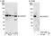 ADP Ribosylation Factor GTPase Activating Protein 1 antibody, A302-029A, Bethyl Labs, Immunoprecipitation image 
