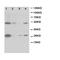 Heat Shock Protein Family B (Small) Member 1 antibody, PA1121, Boster Biological Technology, Western Blot image 