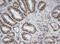 Cullin 4B antibody, M02253, Boster Biological Technology, Immunohistochemistry paraffin image 