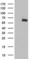 Acyl-CoA Synthetase Medium Chain Family Member 5 antibody, MA5-25918, Invitrogen Antibodies, Western Blot image 