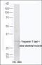 Troponin T3, Fast Skeletal Type antibody, orb186267, Biorbyt, Western Blot image 