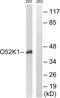 Olfactory Receptor Family 52 Subfamily K Member 1 antibody, PA5-39840, Invitrogen Antibodies, Western Blot image 