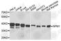 Nucleophosmin 1 antibody, A0486, ABclonal Technology, Western Blot image 