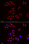 Nephrocystin 1 antibody, STJ28757, St John