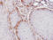 Argininosuccinate Synthase 1 antibody, LS-C185399, Lifespan Biosciences, Immunohistochemistry paraffin image 