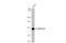 Rho/Rac Guanine Nucleotide Exchange Factor 18 antibody, GTX102223, GeneTex, Western Blot image 
