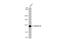 Rho guanine nucleotide exchange factor 18 antibody, GTX102223, GeneTex, Western Blot image 