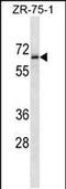 Transmembrane Protein 117 antibody, PA5-48759, Invitrogen Antibodies, Western Blot image 