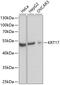 Keratin 17 antibody, GTX32548, GeneTex, Western Blot image 