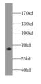 Frizzled Class Receptor 10 antibody, FNab03219, FineTest, Western Blot image 