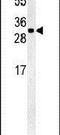 TM2 Domain Containing 3 antibody, PA5-25283, Invitrogen Antibodies, Western Blot image 