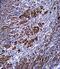 S100 Calcium Binding Protein B antibody, PA5-24996, Invitrogen Antibodies, Immunohistochemistry paraffin image 