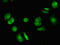 Vacuolar Protein Sorting 4 Homolog B antibody, CSB-PA025915LA01HU, Cusabio, Immunofluorescence image 