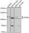 DExD/H-Box Helicase 58 antibody, LS-C748457, Lifespan Biosciences, Western Blot image 