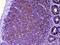 Cytotoxic T-Lymphocyte Associated Protein 4 antibody, A00020-1, Boster Biological Technology, Immunohistochemistry paraffin image 