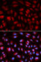 Polo Like Kinase 1 antibody, 18-702, ProSci, Immunofluorescence image 
