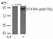 Signal Transducer And Activator Of Transcription 5A antibody, PA5-37744, Invitrogen Antibodies, Western Blot image 