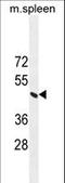 ERCC Excision Repair 8, CSA Ubiquitin Ligase Complex Subunit antibody, LS-C167800, Lifespan Biosciences, Western Blot image 