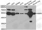 Matrix Metallopeptidase 8 antibody, A3031, ABclonal Technology, Western Blot image 