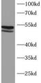 MEK7 antibody, FNab10158, FineTest, Western Blot image 
