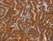 Dipeptidyl transferase antibody, LS-C403028, Lifespan Biosciences, Immunohistochemistry paraffin image 