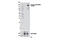 ERBB2 antibody, 88583S, Cell Signaling Technology, Western Blot image 
