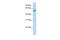 Glycoprotein Nmb antibody, PA5-42585, Invitrogen Antibodies, Western Blot image 