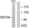 Eukaryotic Elongation Factor 2 Kinase antibody, LS-C117564, Lifespan Biosciences, Western Blot image 