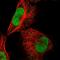 Ankyrin Repeat And BTB Domain Containing 2 antibody, HPA020065, Atlas Antibodies, Immunofluorescence image 