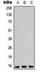 Proliferation And Apoptosis Adaptor Protein 15 antibody, orb315648, Biorbyt, Western Blot image 