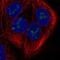 Double Zinc Ribbon And Ankyrin Repeat Domains 1 antibody, NBP2-57571, Novus Biologicals, Immunofluorescence image 