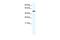 Homeobox A3 antibody, GTX48996, GeneTex, Western Blot image 