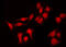 Involucrin antibody, GTX03271, GeneTex, Immunofluorescence image 