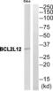 BCL2 Like 12 antibody, abx014252, Abbexa, Western Blot image 