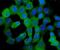 Heat Shock Protein Family B (Small) Member 8 antibody, M02492-2, Boster Biological Technology, Immunofluorescence image 