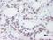 NUP214 antibody, IHC-00103, Bethyl Labs, Immunohistochemistry frozen image 