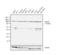 Proteasome 26S Subunit, Non-ATPase 2 antibody, GTX79499, GeneTex, Western Blot image 