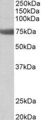 Transglutaminase-3-like antibody, PA5-38000, Invitrogen Antibodies, Western Blot image 