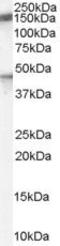 Patched 1 antibody, PA5-18544, Invitrogen Antibodies, Western Blot image 