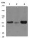 Cyclin Dependent Kinase Inhibitor 1C antibody, ab75974, Abcam, Western Blot image 