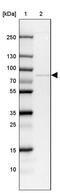 Treacle Ribosome Biogenesis Factor 1 antibody, PA5-58309, Invitrogen Antibodies, Western Blot image 