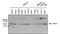 AKT Serine/Threonine Kinase 2 antibody, MA1-034X, Invitrogen Antibodies, Western Blot image 