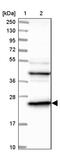 Thymidylate kinase antibody, PA5-60040, Invitrogen Antibodies, Western Blot image 