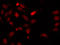 Heterogeneous Nuclear Ribonucleoprotein F antibody, LS-C334099, Lifespan Biosciences, Immunofluorescence image 