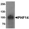 PHD Finger Protein 14 antibody, LS-B10132, Lifespan Biosciences, Western Blot image 