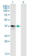 MAGE Family Member A3 antibody, H00004102-M01, Novus Biologicals, Western Blot image 