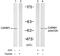 Coactivator Associated Arginine Methyltransferase 1 antibody, GTX79118, GeneTex, Western Blot image 