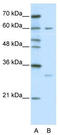 Zinc Finger Protein 395 antibody, TA331849, Origene, Western Blot image 
